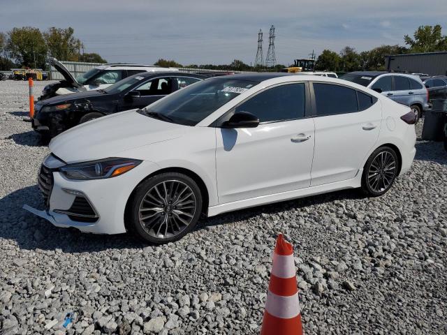 2017 Hyundai Elantra Sport