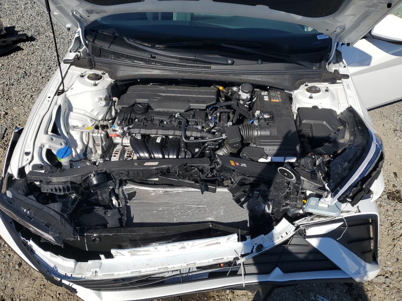 KMHLL4DG6RU766853 2024 Hyundai Elantra Se