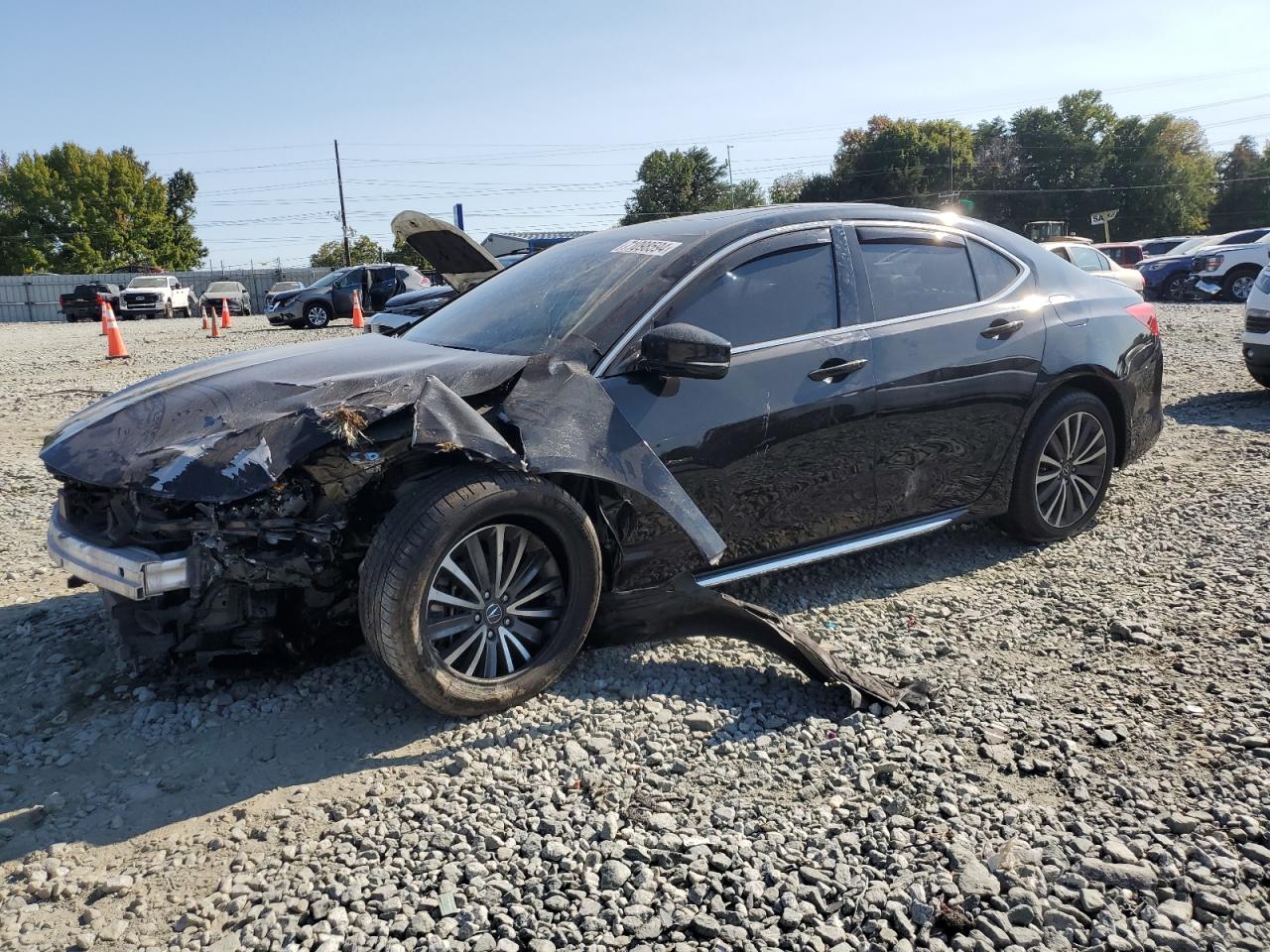 2018 Acura TLX - Image 1