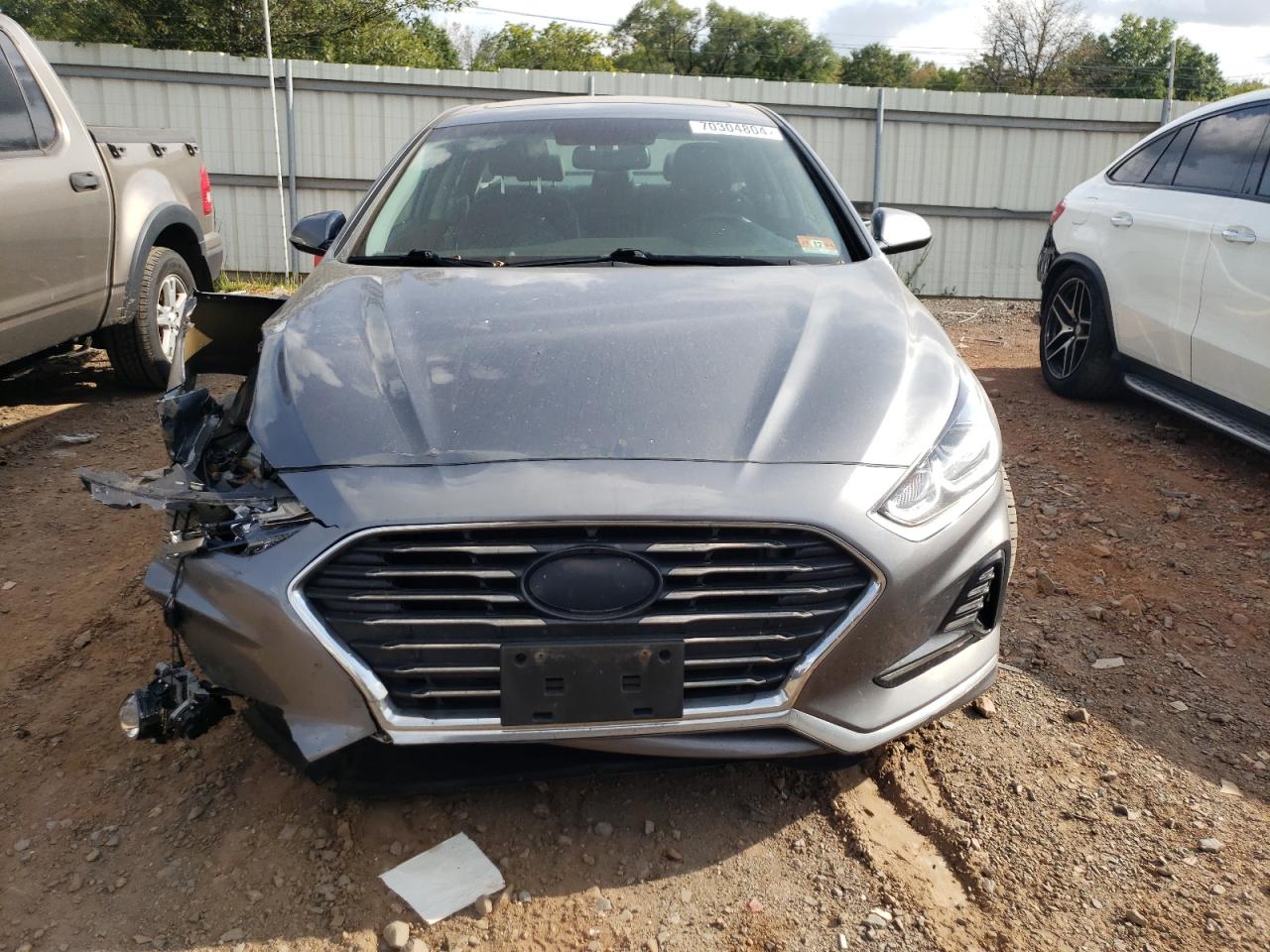 5NPE34AF4JH664992 2018 Hyundai Sonata Sport