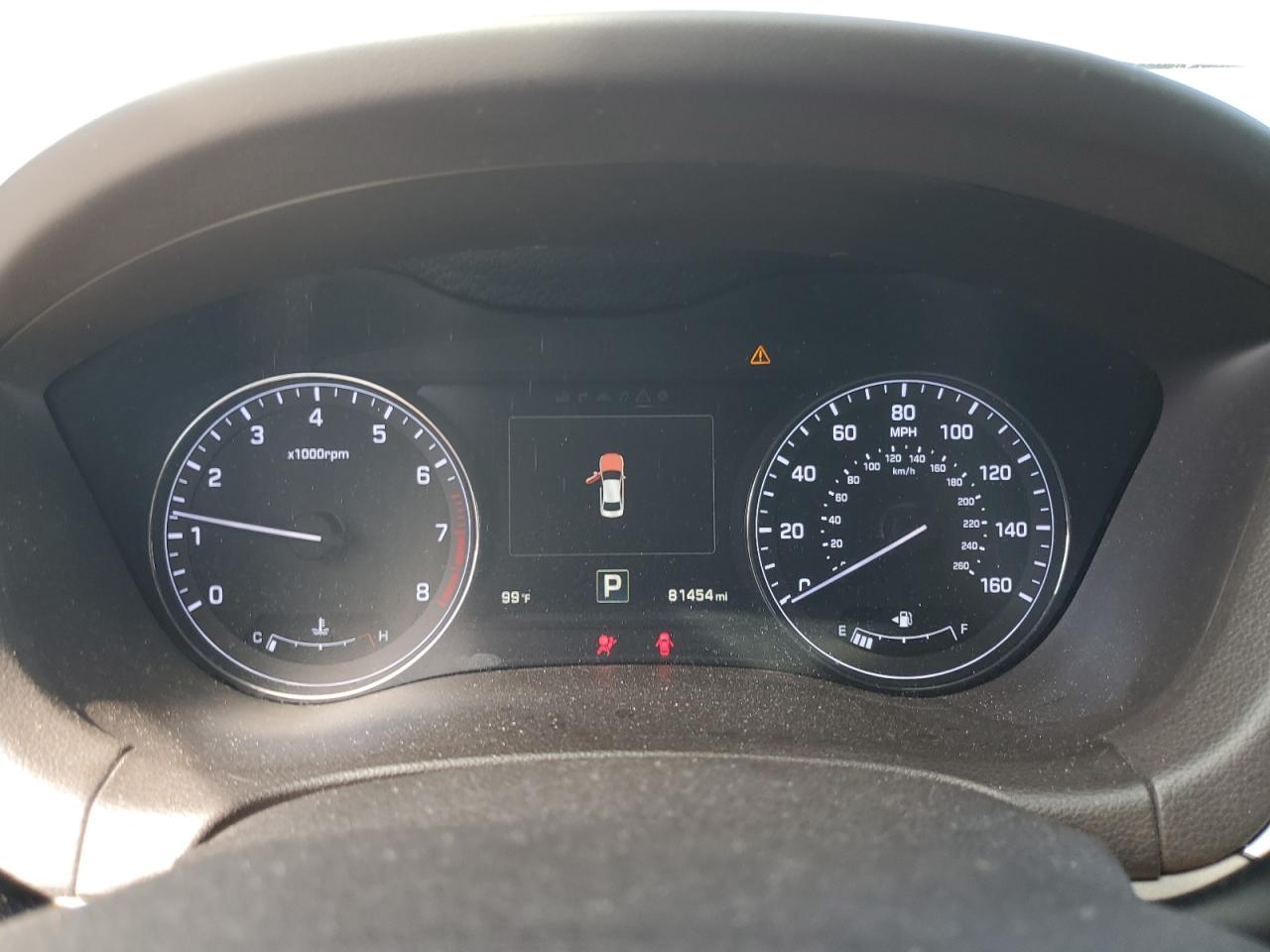 2017 Genesis G80 Base VIN: KMHGN4JE9HU192083 Lot: 81274205