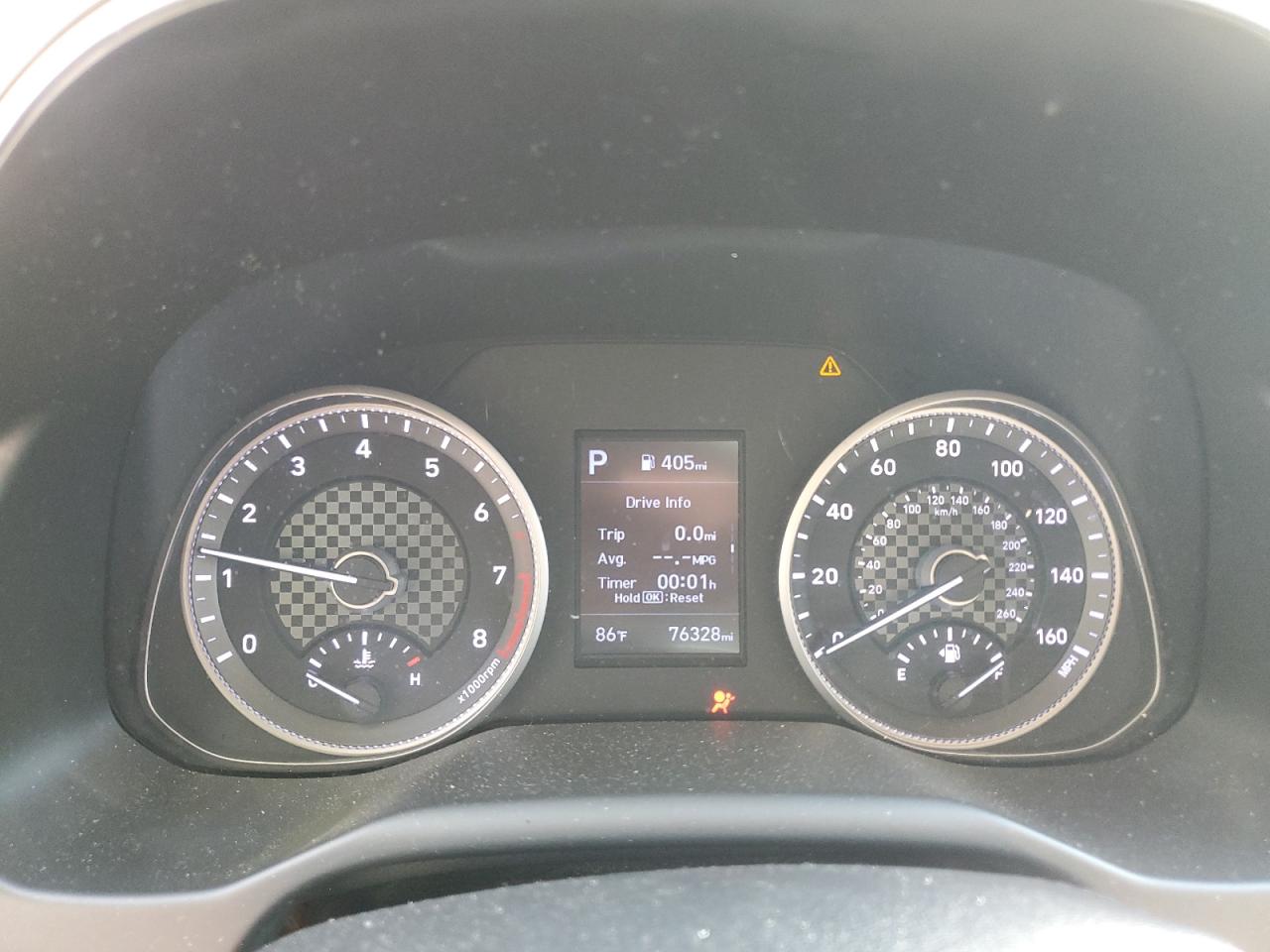 2020 Hyundai Elantra Se VIN: KMHD74LF5LU954157 Lot: 81895905