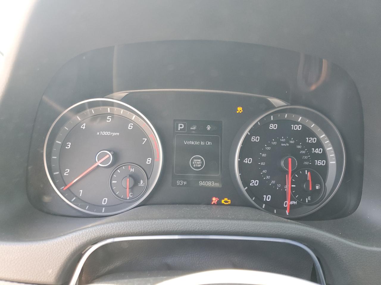 2017 Hyundai Elantra Sport VIN: KMHD04LB1HU359900 Lot: 80021435