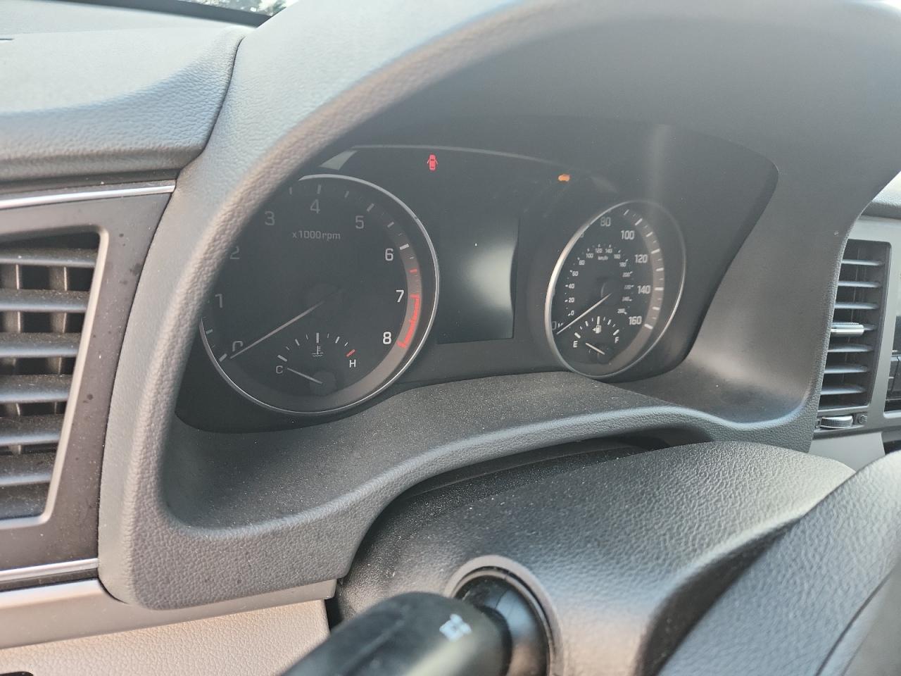 2017 Hyundai Elantra Se VIN: KMHD74LF0HU149836 Lot: 81685605