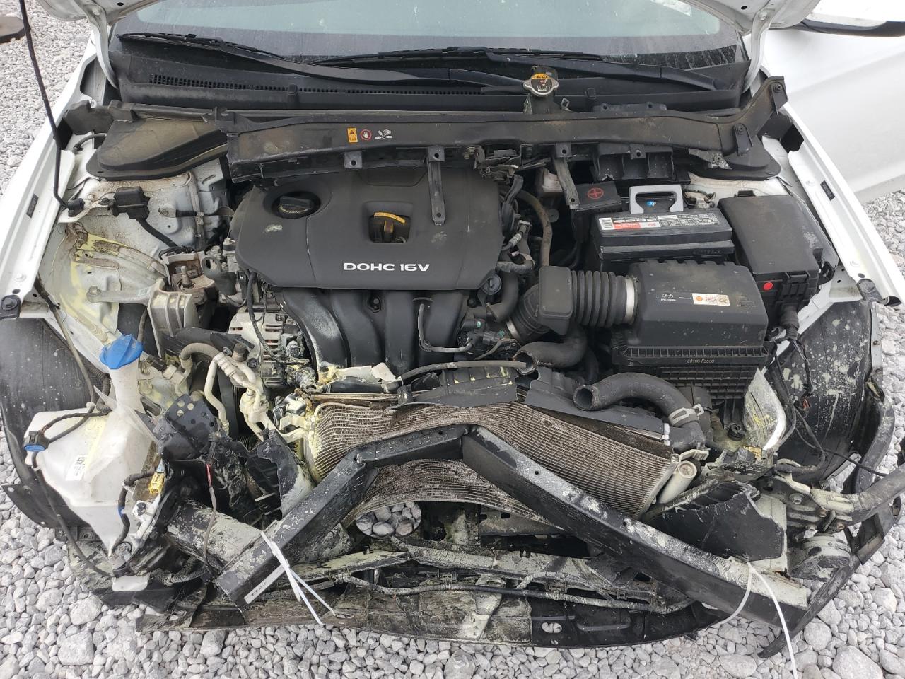 2018 Hyundai Elantra Sel VIN: 5NPD84LF1JH308574 Lot: 81560875