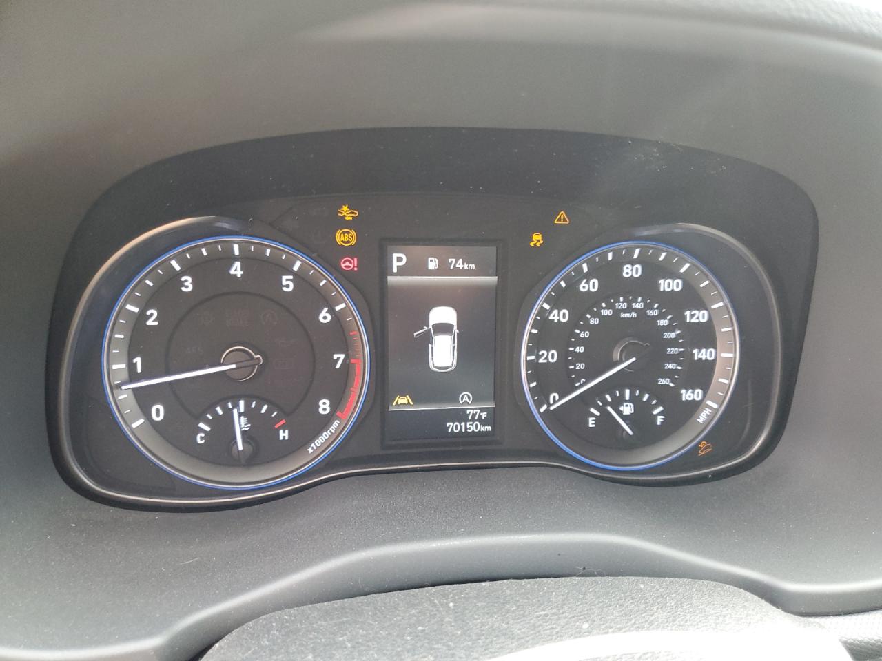 2022 Hyundai Kona Sel VIN: KM8K22ABXNU832861 Lot: 72051855