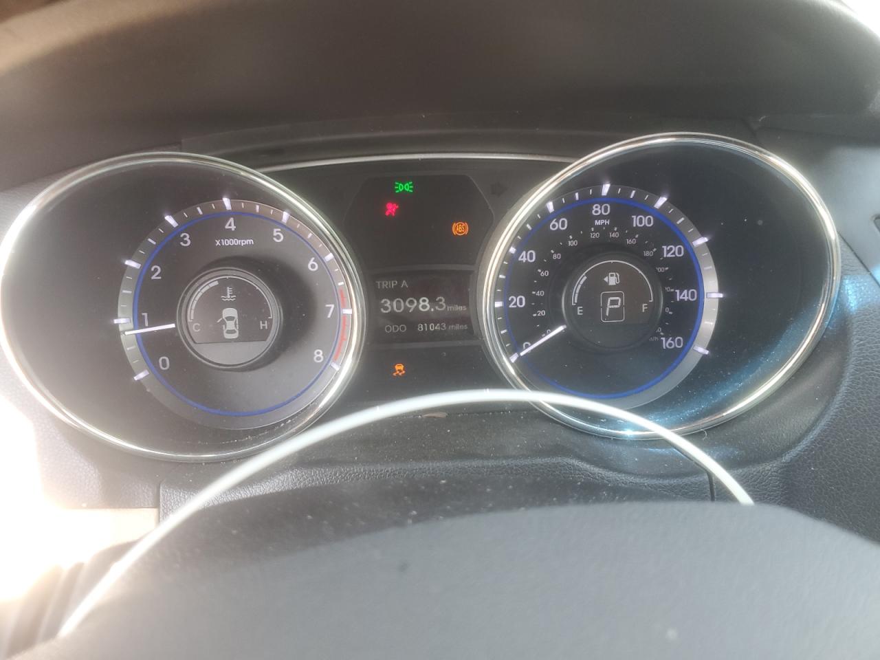 2013 Hyundai Sonata Gls VIN: 5NPEB4AC2DH741307 Lot: 81870625