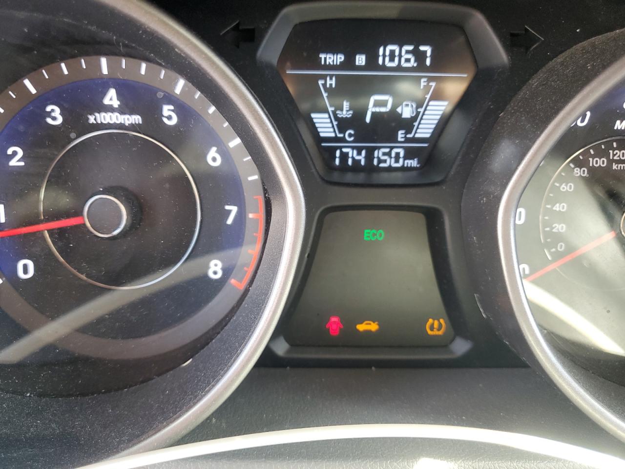 2015 Hyundai Elantra Se VIN: 5NPDH4AE2FH592878 Lot: 84425905