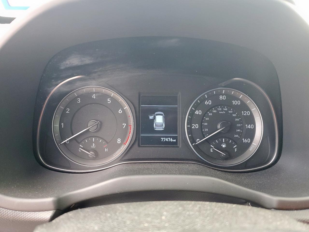 2020 Hyundai Kona Sel VIN: KM8K22AA6LU479796 Lot: 81677375