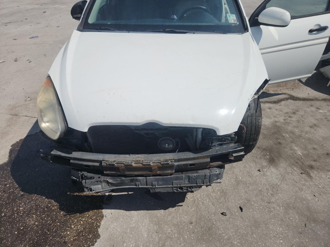 2010 Hyundai Accent Gls VIN: KMHCN4AC6AU418020 Lot: 81866685