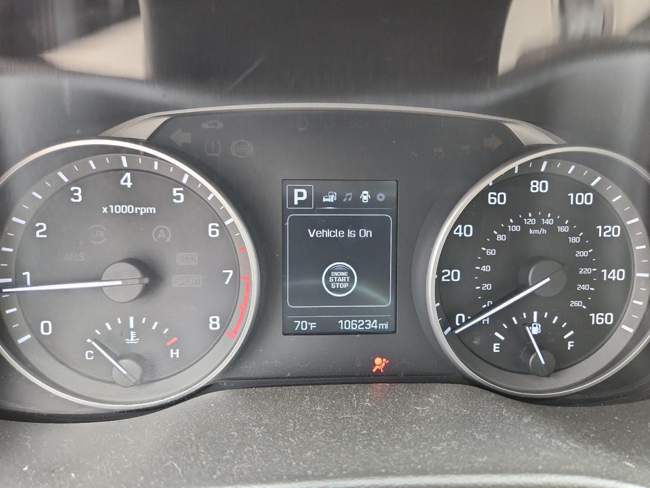 2017 Hyundai Elantra Se VIN: 5NPD84LF2HH187239 Lot: 82048725