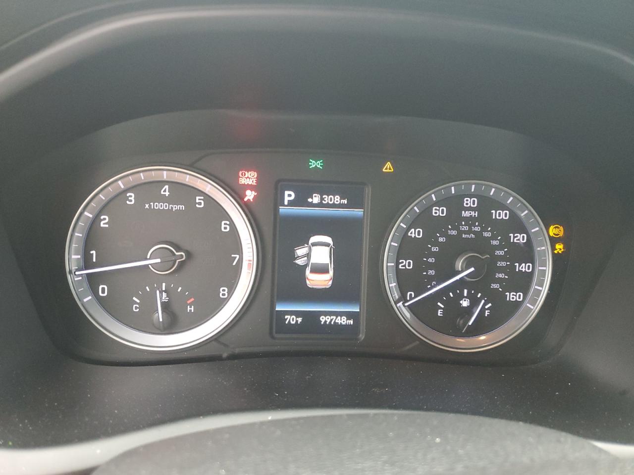 2018 Hyundai Sonata Sport VIN: 5NPE34AF3JH610518 Lot: 81846125