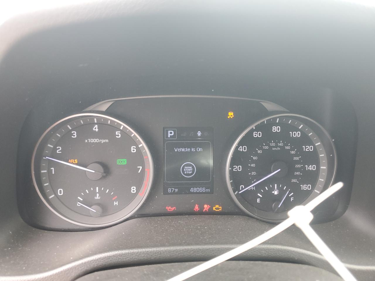 2017 Hyundai Elantra Se VIN: 5NPD84LF8HH148123 Lot: 82147095