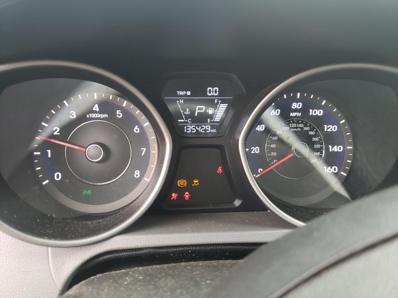 2014 Hyundai Elantra Se VIN: 5NPDH4AE8EH476406 Lot: 80634125