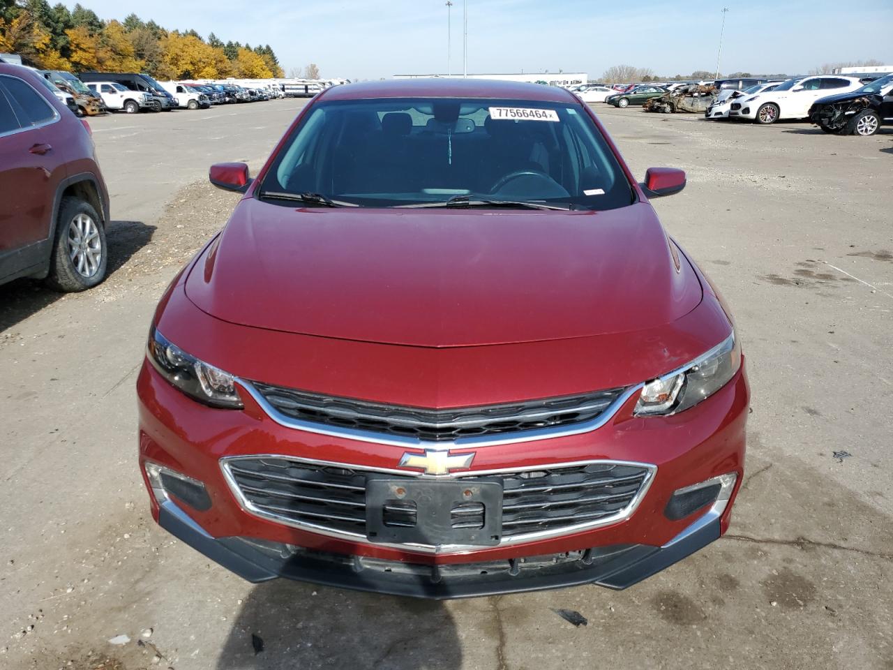 2017 Chevrolet Malibu - Image 5