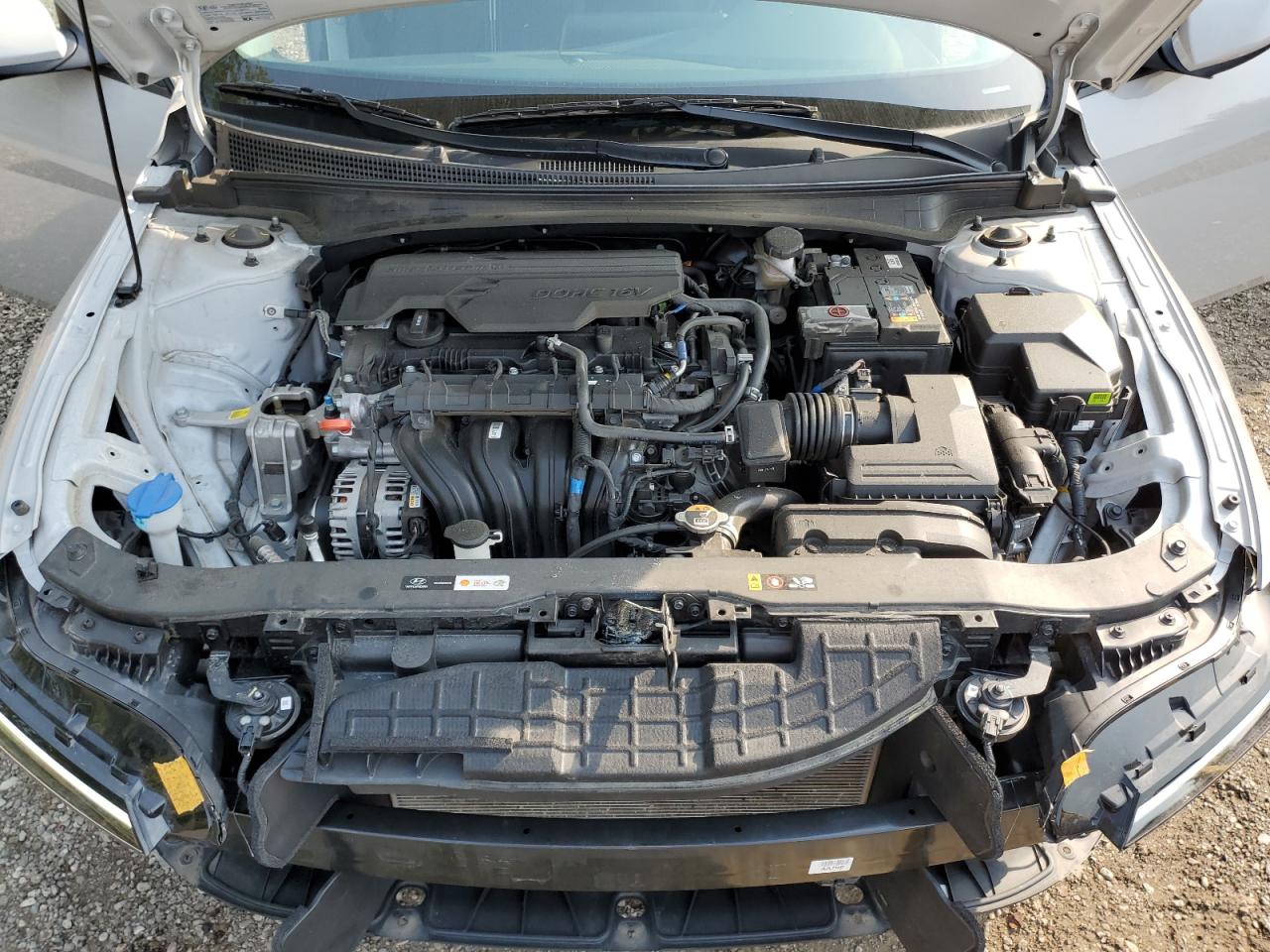 KMHLM4DG1RU666477 2024 Hyundai Elantra Sel