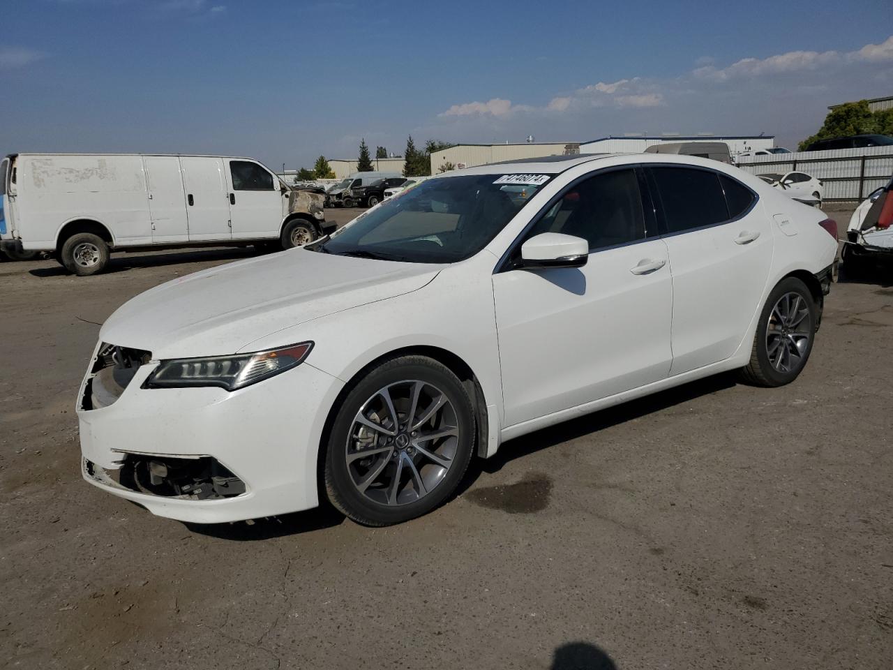 2015 Acura TLX - Image 1