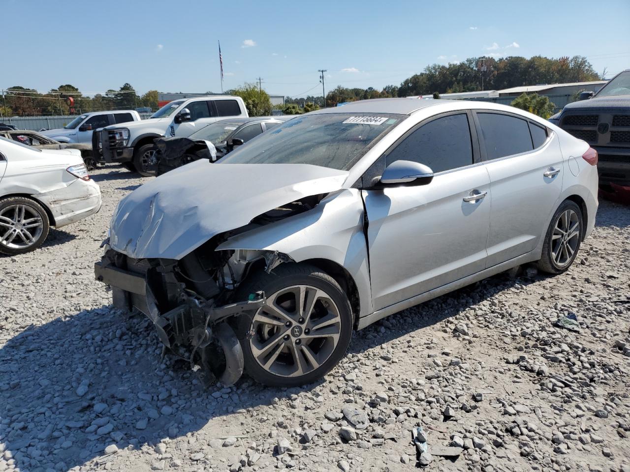 2017 Hyundai Elantra - Image 1