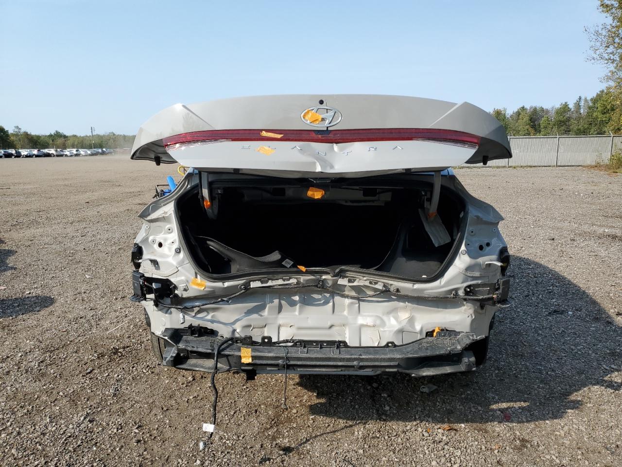 KMHLM4DG1RU666477 2024 Hyundai Elantra Sel