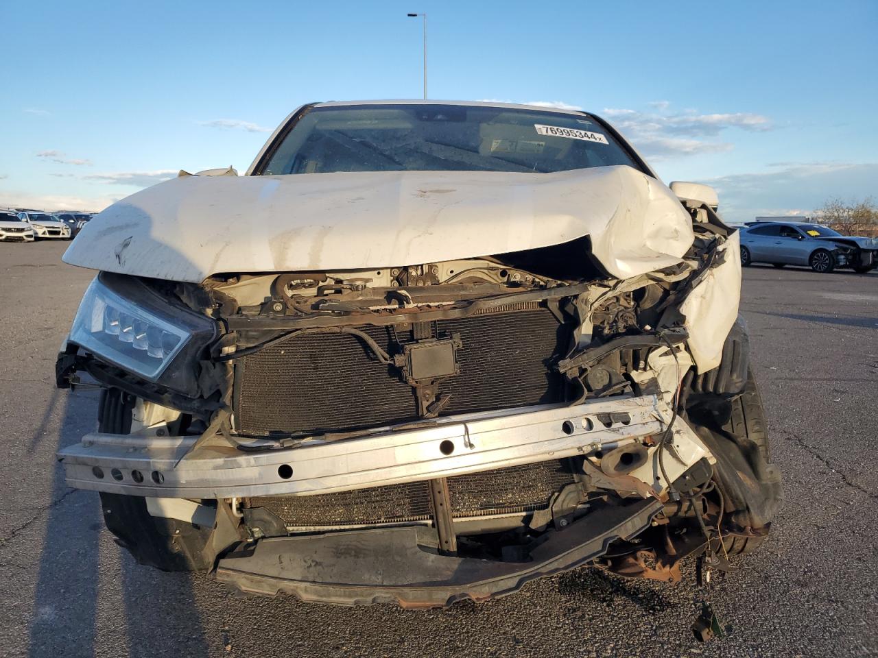 2017 Acura MDX - Image 5