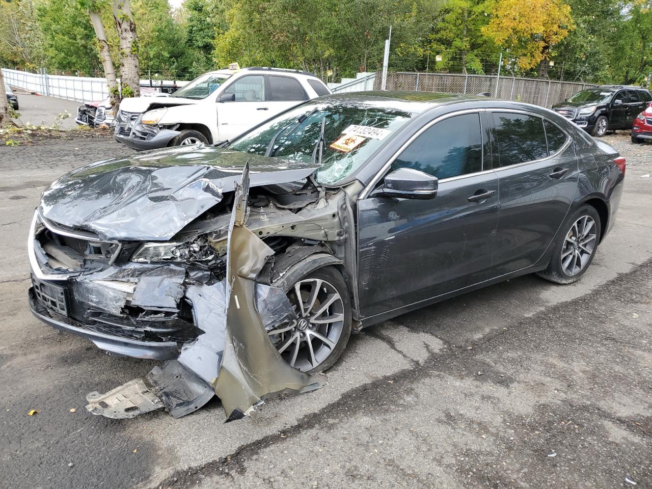2016 Acura TLX - Image 1