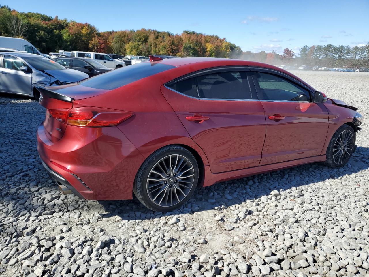 2017 Hyundai Elantra - Image 3