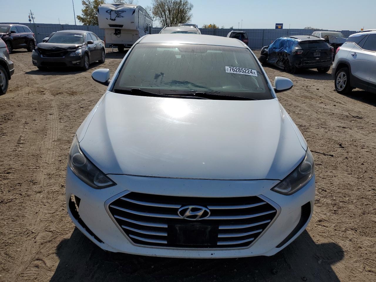 2017 Hyundai Elantra - Image 5