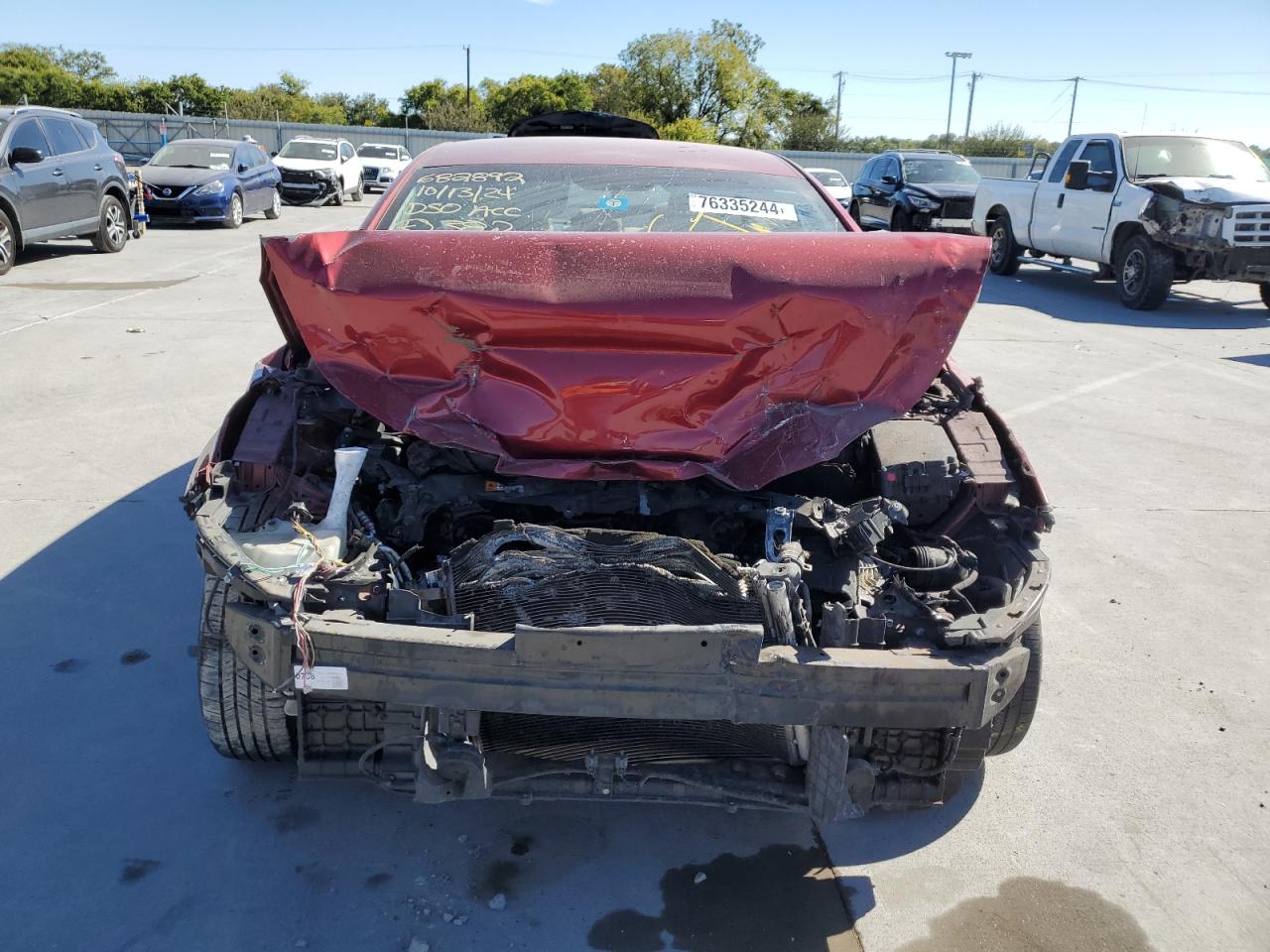 2016 Hyundai Elantra - Image 5