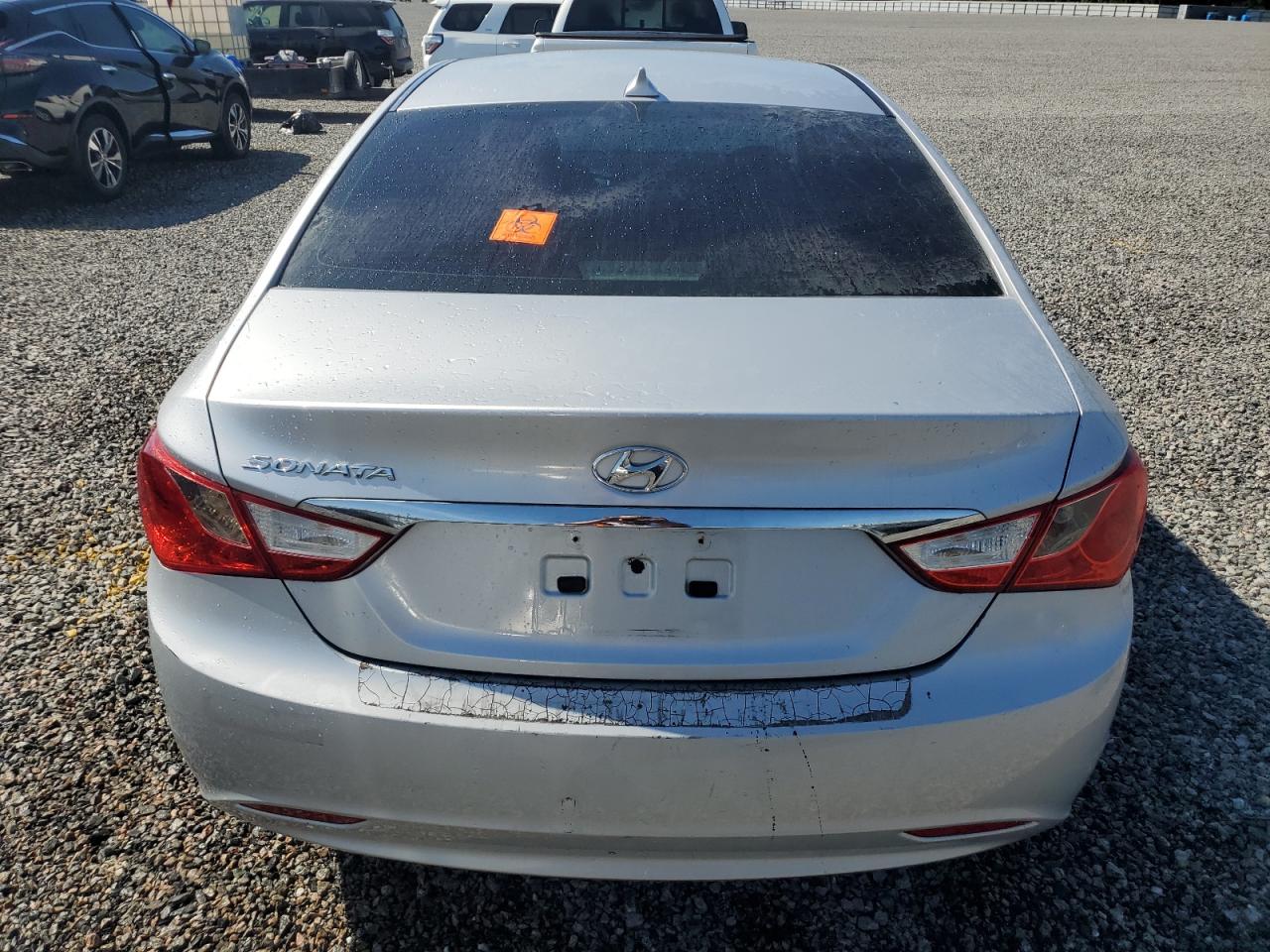 2013 Hyundai Sonata Gls VIN: 5NPEB4AC7DH515828 Lot: 76665654