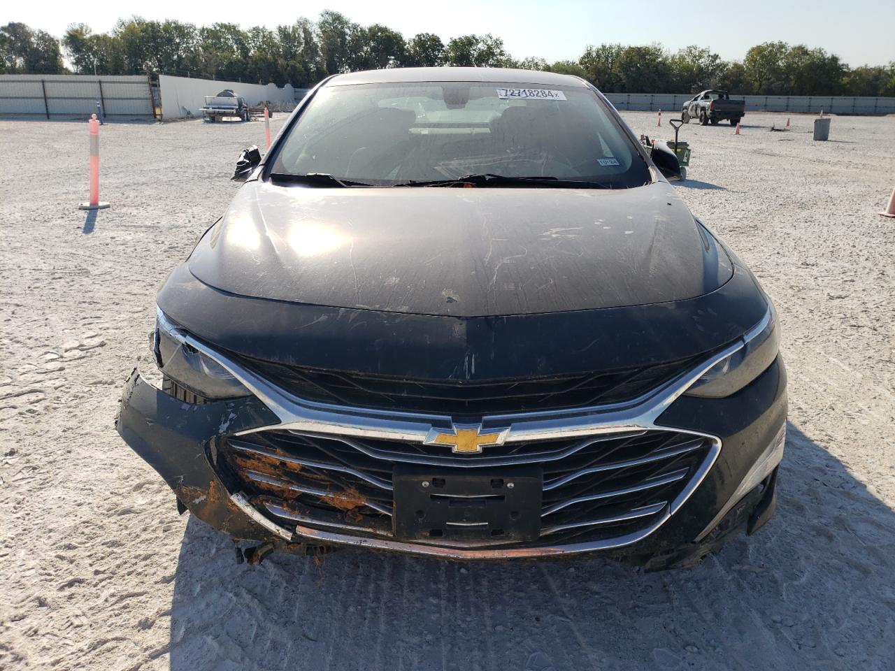 2020 Chevrolet Malibu - Image 5