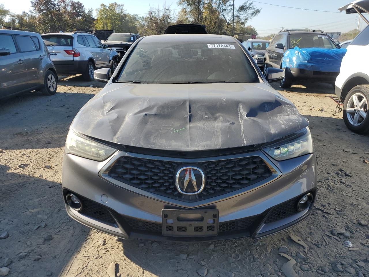 2018 Acura TLX - Image 5