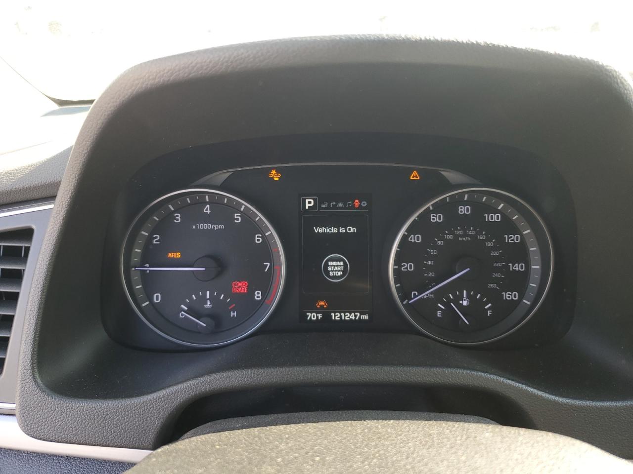 2017 Hyundai Elantra - Image 9