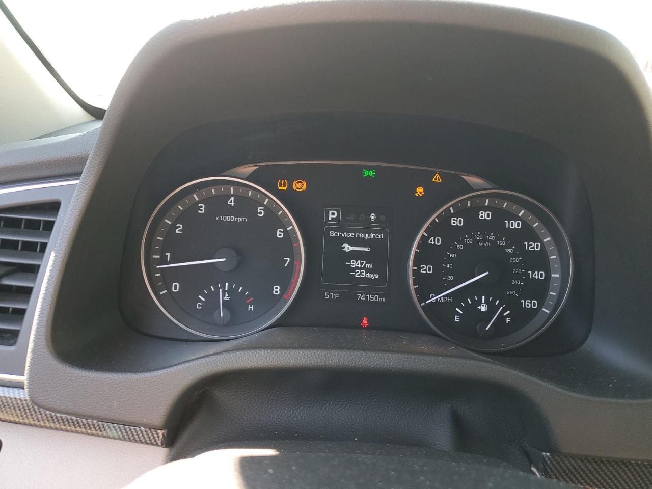 2018 Hyundai Elantra - Image 9