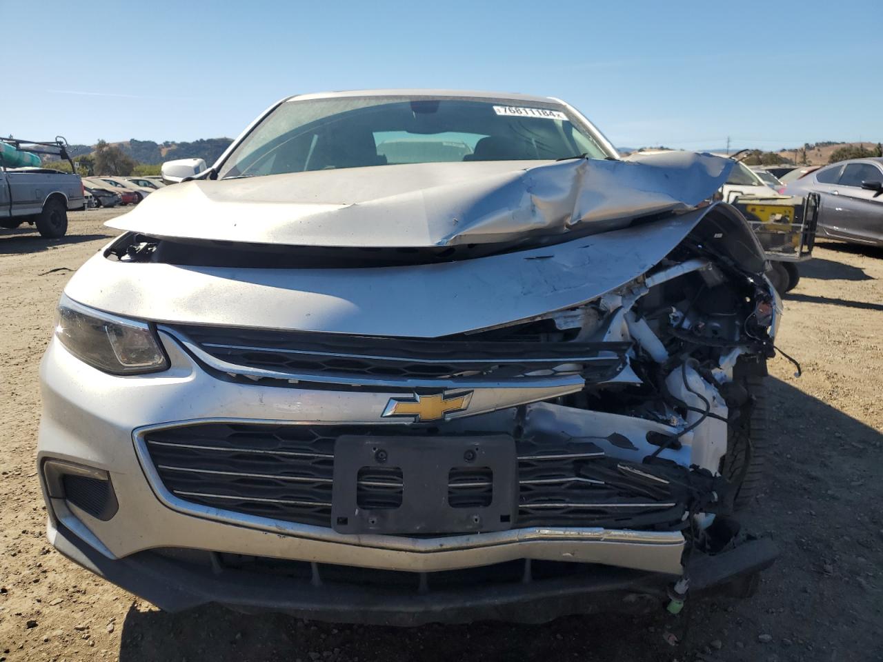 2017 Chevrolet Malibu - Image 5