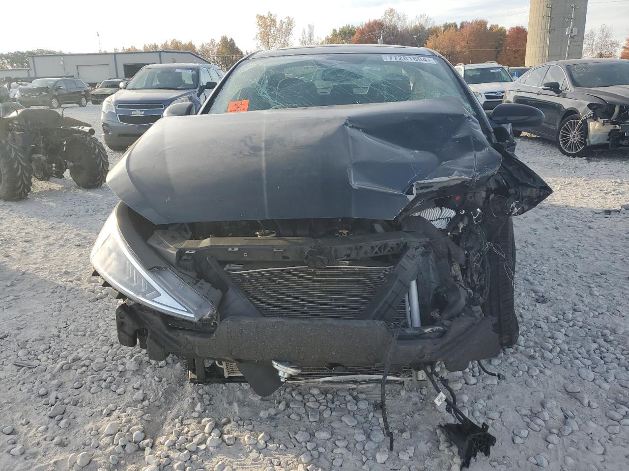 2019 Hyundai Elantra - Image 5