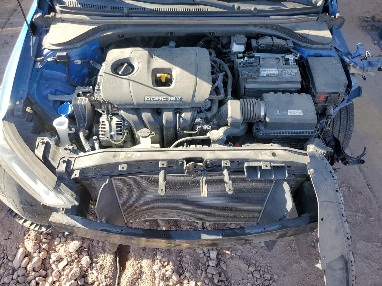 KMHD84LF9JU609076 2018 Hyundai Elantra Sel