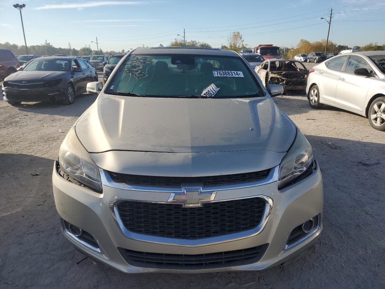 2014 Chevrolet Malibu - Image 5