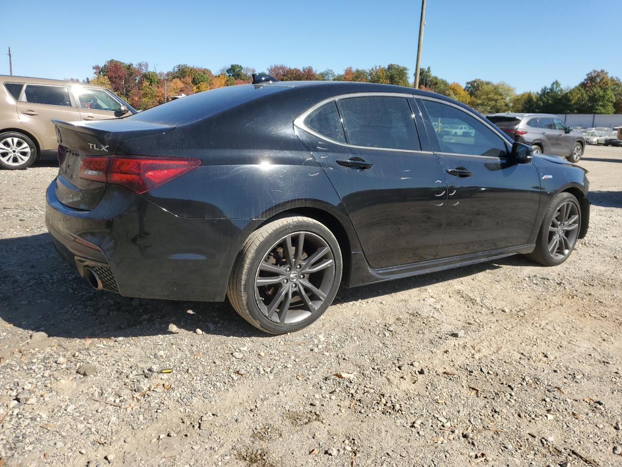 2018 Acura TLX - Image 3