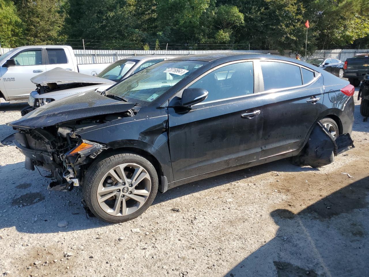 2017 Hyundai Elantra - Image 1