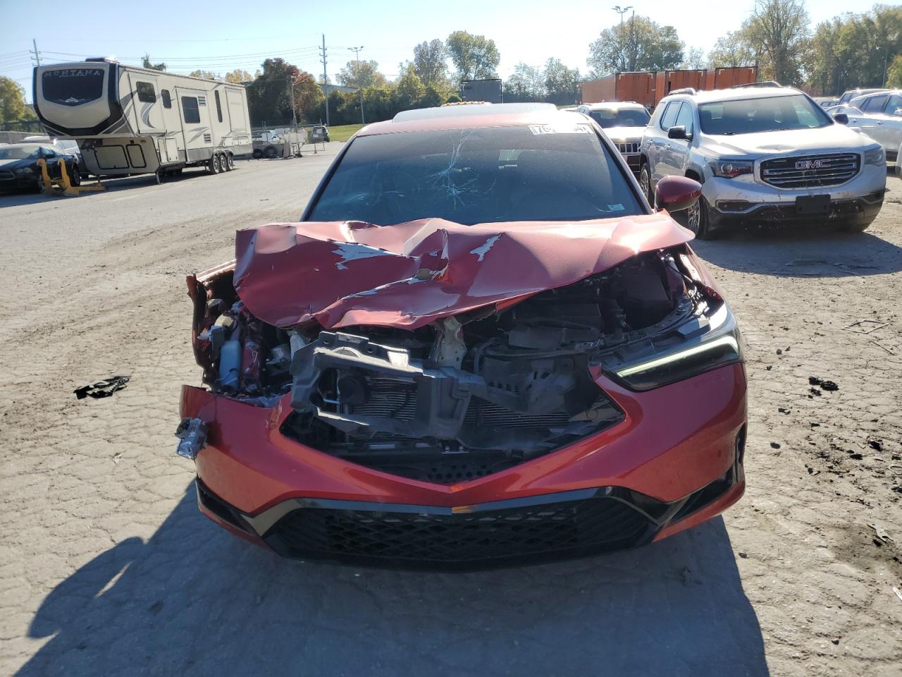 2023 Acura Integra - Image 5