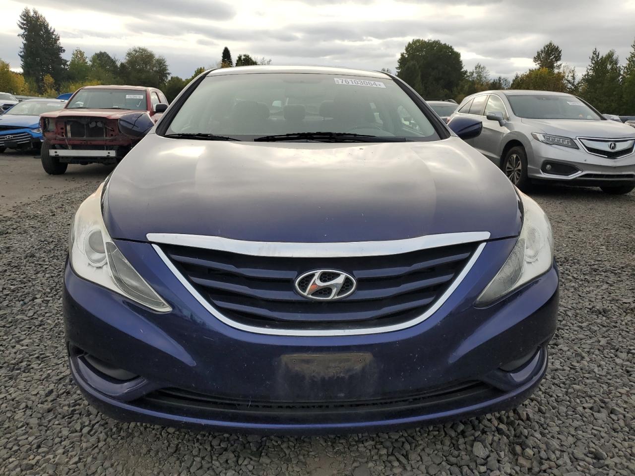 2013 Hyundai Sonata Gls VIN: 5NPEB4AC6DH701067 Lot: 76103064