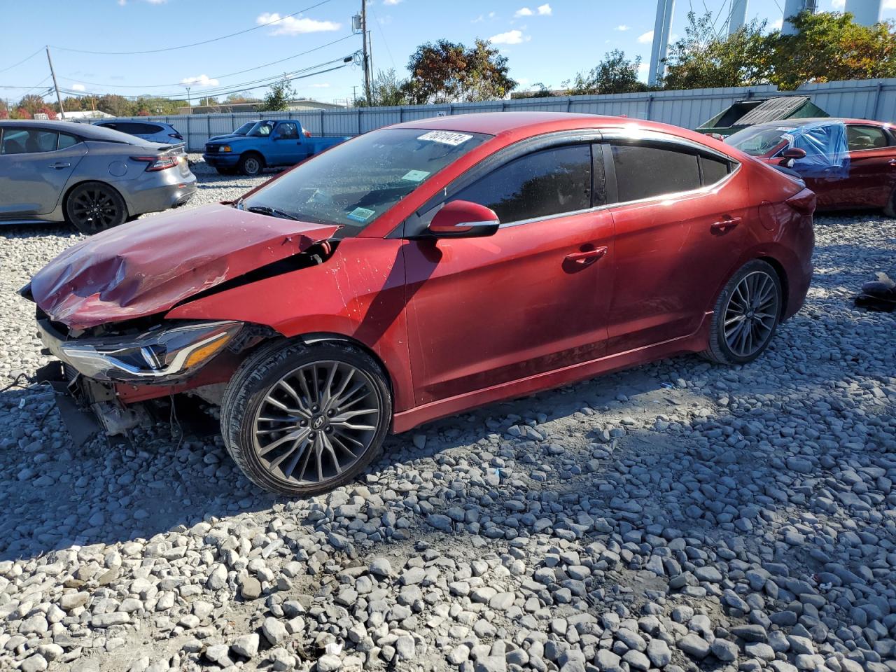 2017 Hyundai Elantra - Image 1
