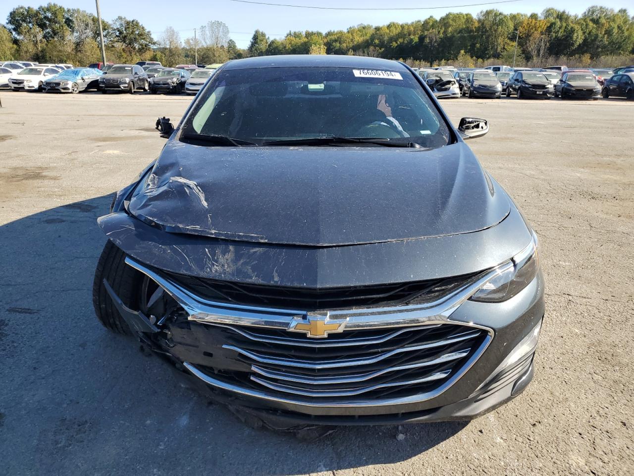 2020 Chevrolet Malibu - Image 5