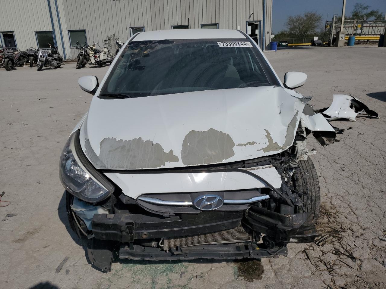 2016 Hyundai Accent - Image 5