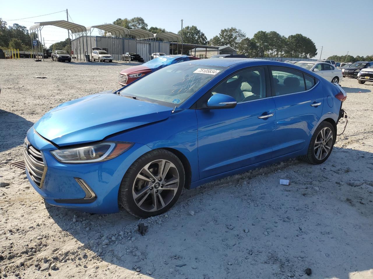 2017 Hyundai Elantra - Image 1