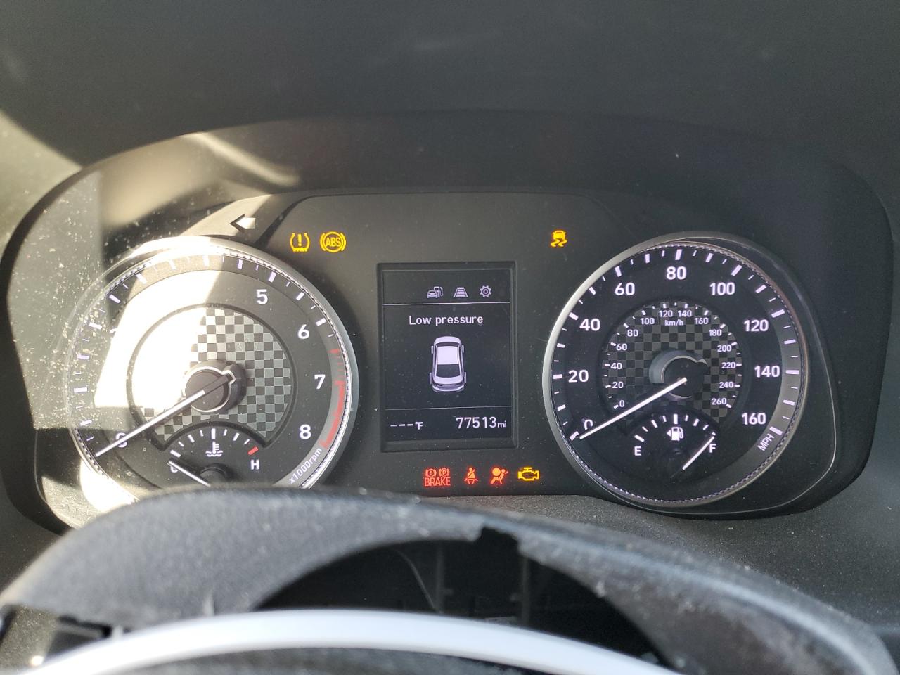 2020 Hyundai Elantra - Image 9