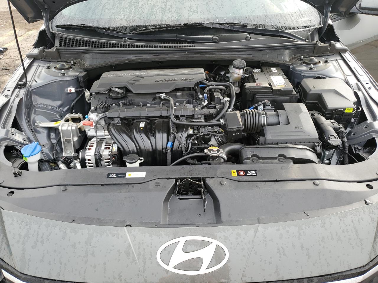 KMHLM4DG0RU758034 2024 Hyundai Elantra Sel