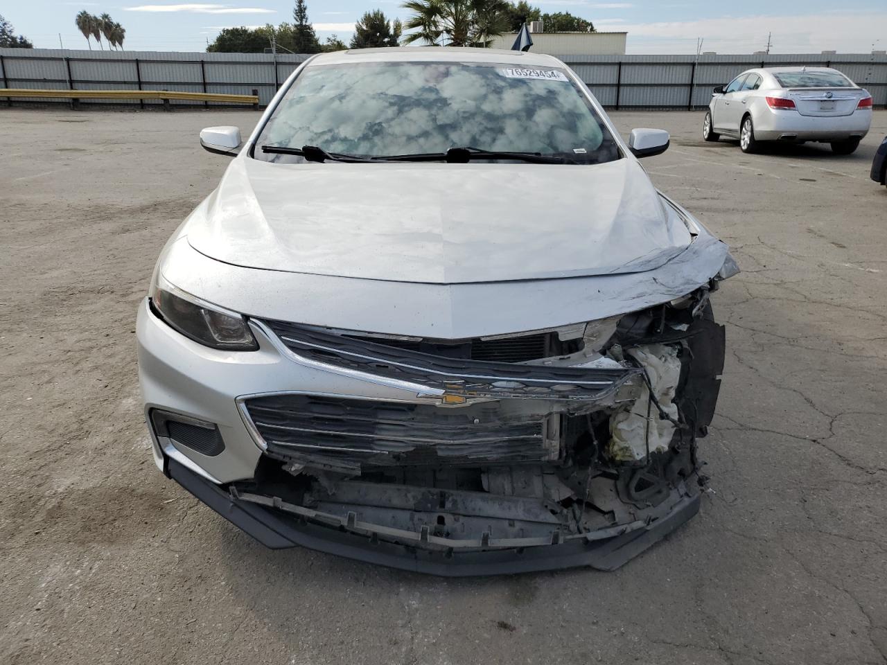 VIN 1G1ZD5STXJF152715 2018 CHEVROLET MALIBU no.5