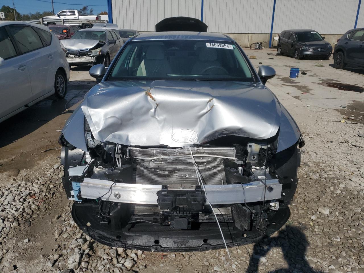2024 Hyundai Sonata - Image 5