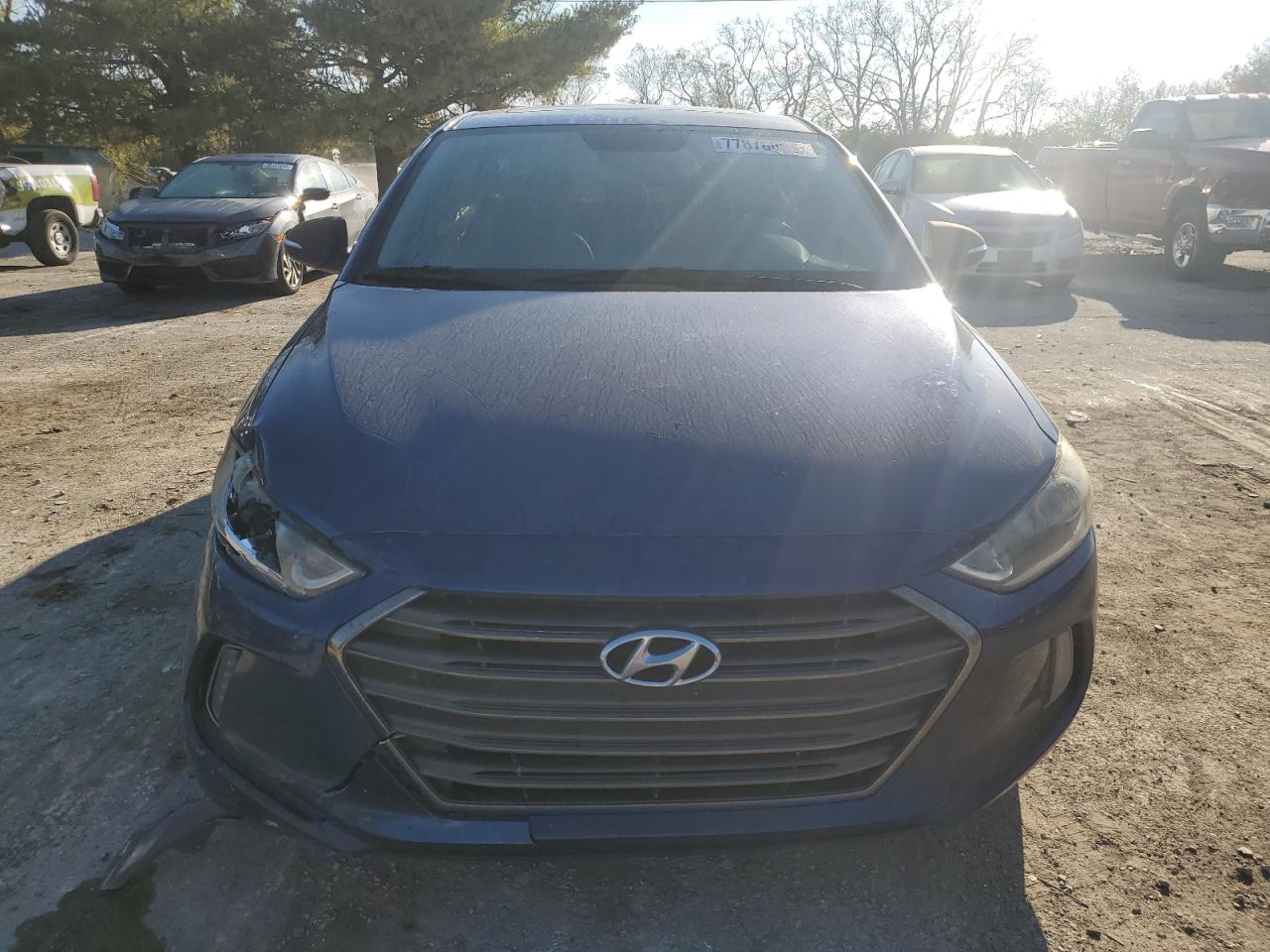 2017 Hyundai Elantra - Image 5